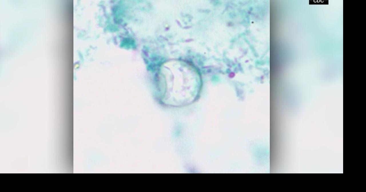 Cyclospora reported in 6 more states, bringing total to 15