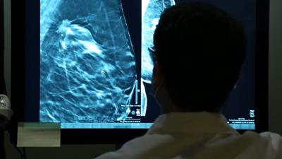 UofL Health colonoscopy.jpeg