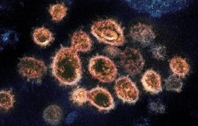 Coronavirus generic electron microscope