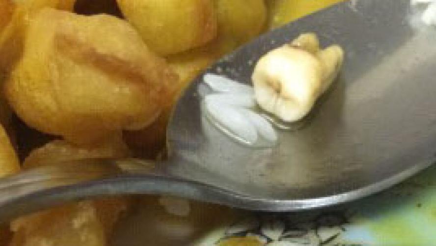 Tooth in Food 10-31-19 Fox News.jpg