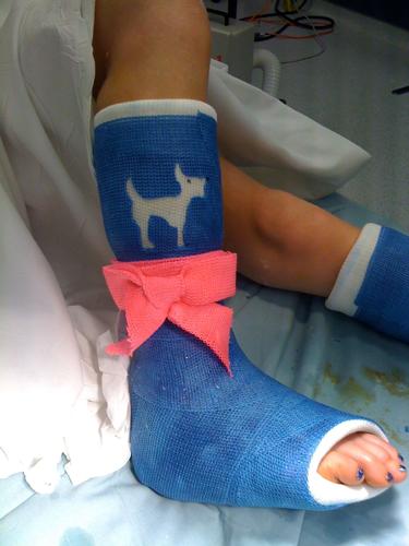 Blue cast with pink bow