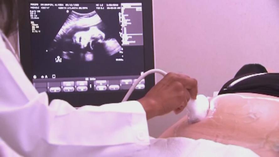 House Bill 2 abortion
