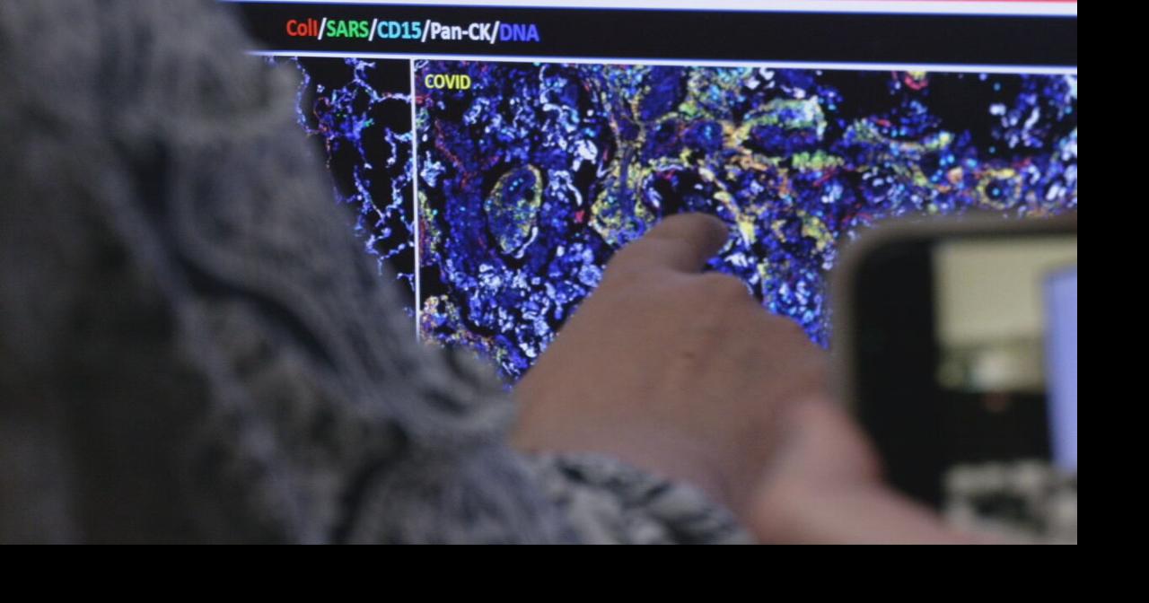 UofL Health receives $11.5 million grant to expand cancer immunotherapy research