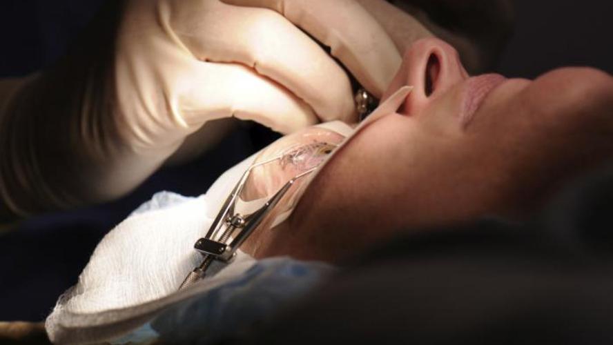 LASIK surgery (generic)