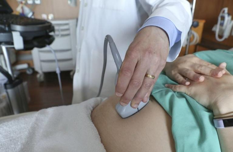 Pregnant  ULTRASOUND - AP FILE