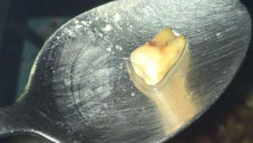 Tooth in Chinese Food 10-31-19 Fox News.jpg