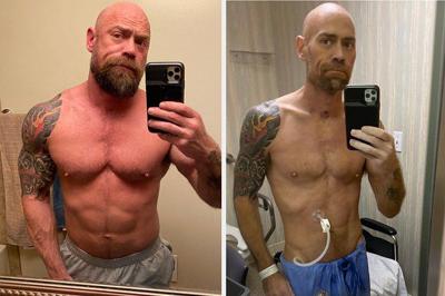 Coronavirus survivor, 43, shares shocking photo showing 50-lb weight loss, National