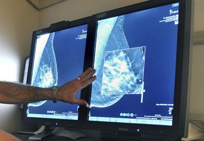 MAMMOGRAM - AP FILE.jpeg