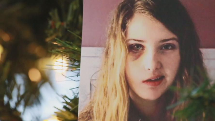 FACING IT - Sunni Wigginton before surgery 1.jpg