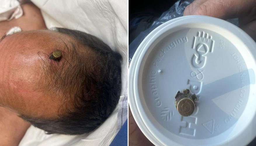Bullet lodged in forehead of Georgia man