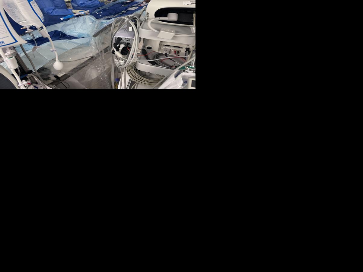 Cath lab - leadless pacemaker.jpeg