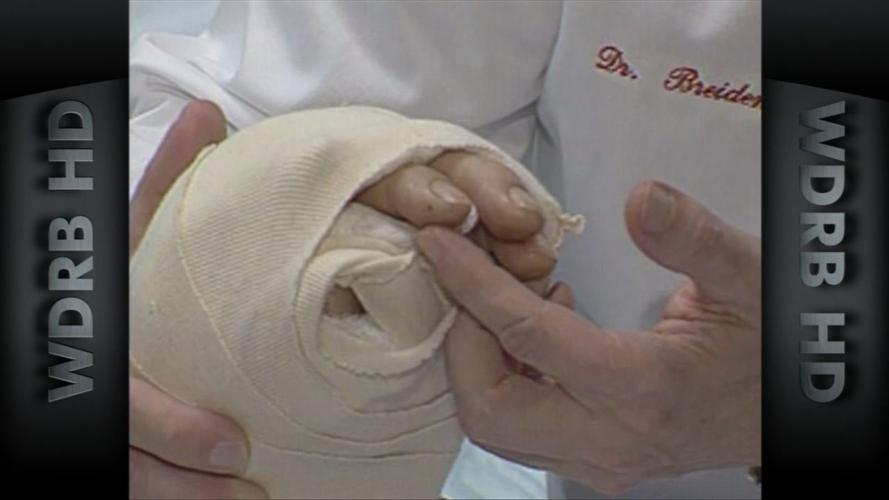 MATTHEW SCOTT - HAND SURGERY 1999 - WDRB (2).jpg