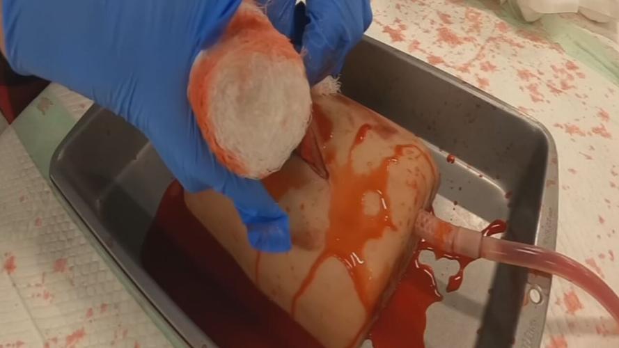 Jeffersontown High School students receive 'Stop the Bleed' training