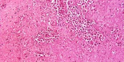 Naegleria fowleri, the brain-eating amoeba that causes primary amebic meningoencephalitis. (Centers for Disease Control and Prevention)