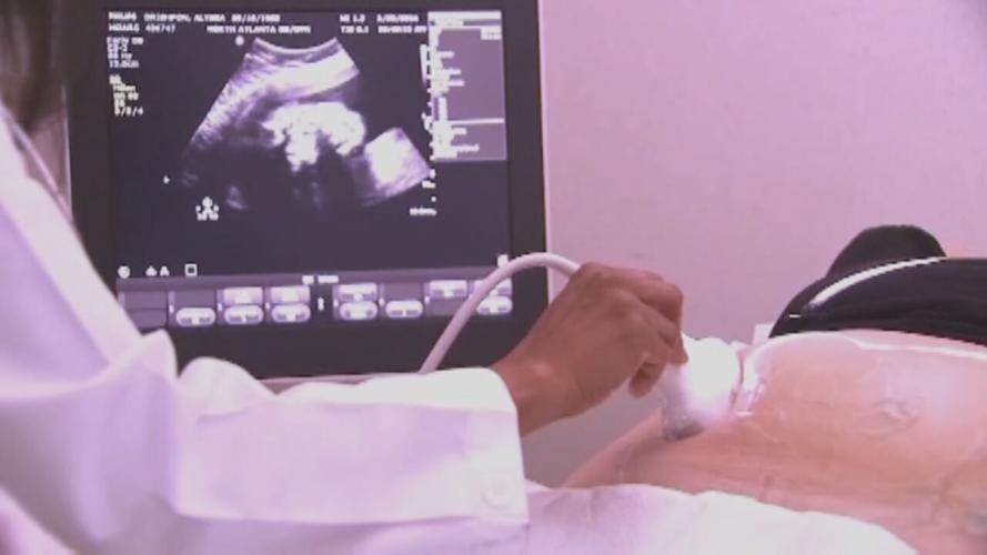 Pregnant woman gets ultrasound