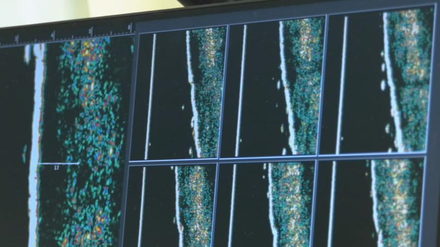 NON-INVASIVE SKIN CANCER TREATMENT (2).jpeg