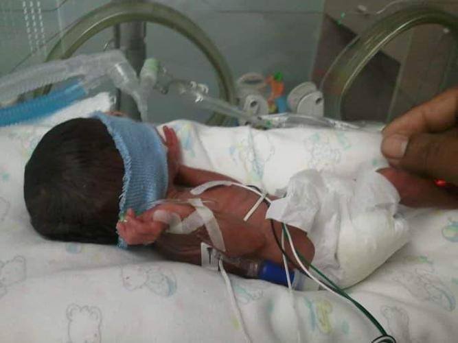 Baby Kaden in the NICU unit at Kosair Children's Hospital