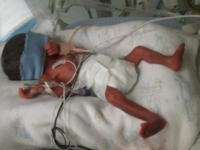 Baby Kaden at Kosair Children's NICU unit