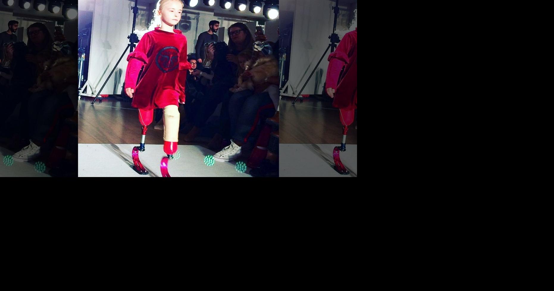 Double amputee DaisyMay Demetre walking