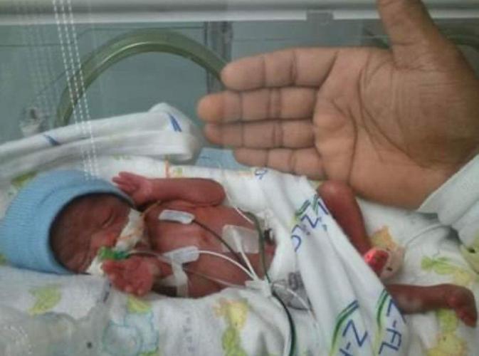 Kaden near father's hand in NICU unit at Kosair Children's Hospital in Louisville