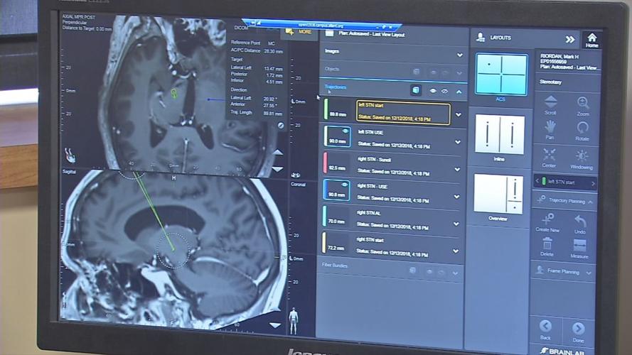 Deep brain stimulation technique