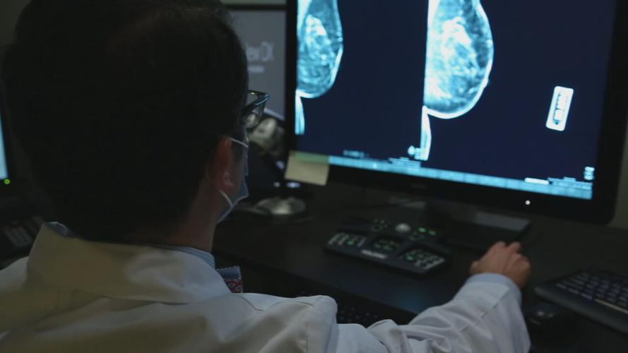 Doctor examines mammogram scans
