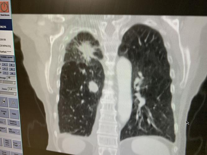 STOP SMOKING - BAPTIST HEALTH FLOYD - KEITH KAISER - 1-10-20  (1).jpeg