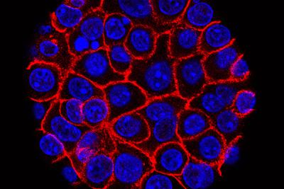 Pancreatic Cancer Drug - AP - 5.31.26