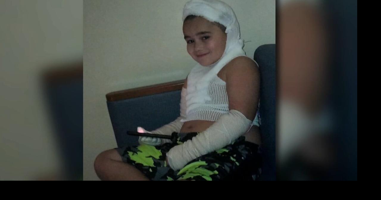 8-year-old Kansas boy severely burned by faulty phone charger while sleeping