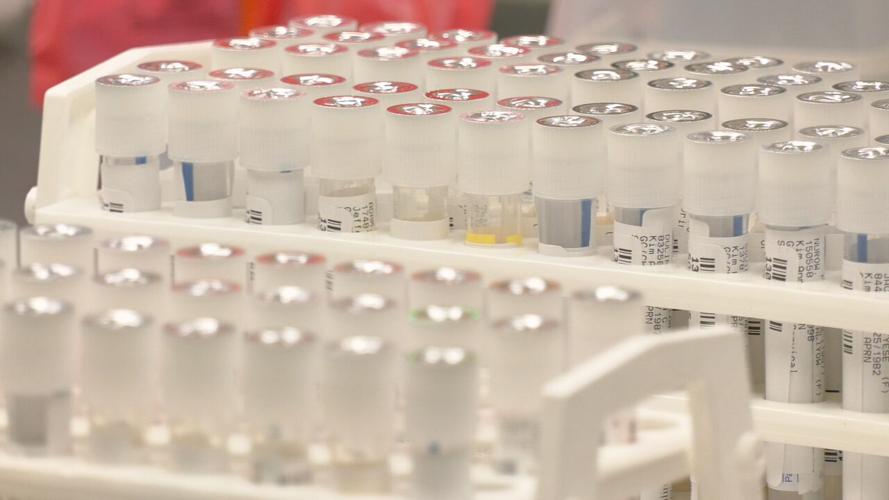 Louisville STI test lab (5).jpeg