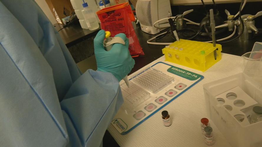 Louisville STI test lab (4).jpeg