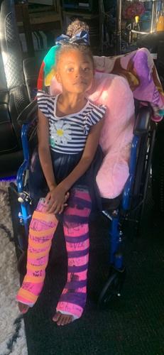 5-year-old girl recovering after breaking both legs in hit and run