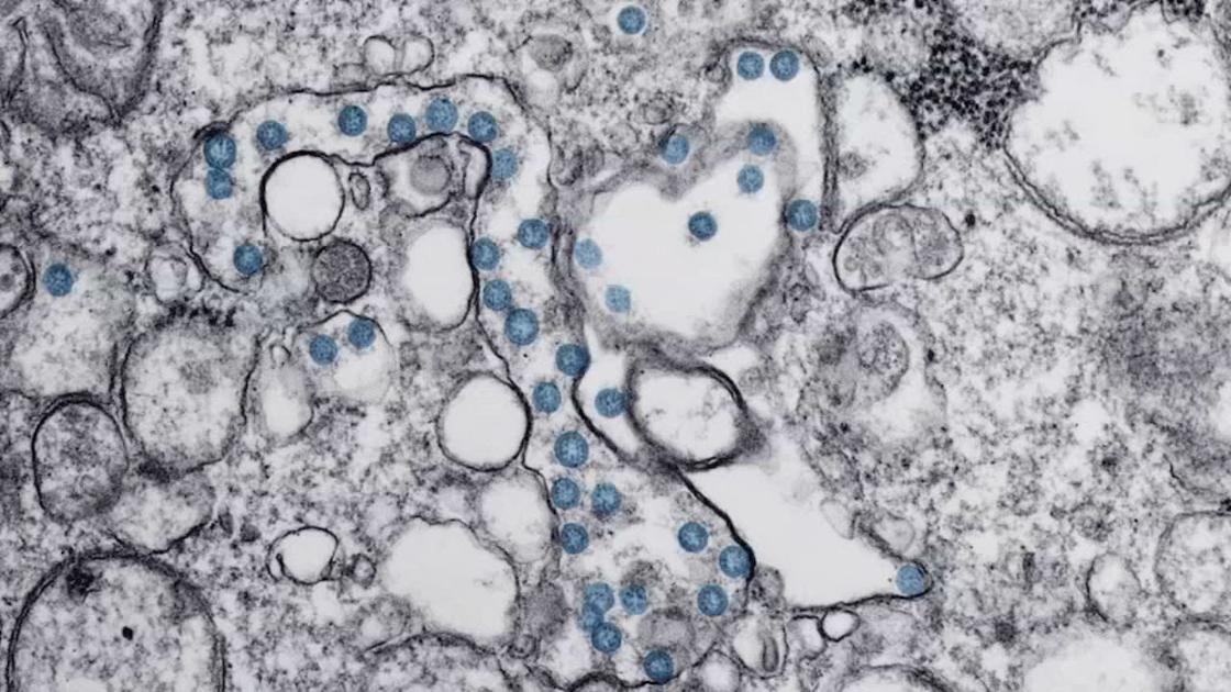 Oldham County Woman Who Tested Positive For Covid 19 Being Treated At Baptist Health La Grange Health Officials Say Coronavirus Wdrb Com