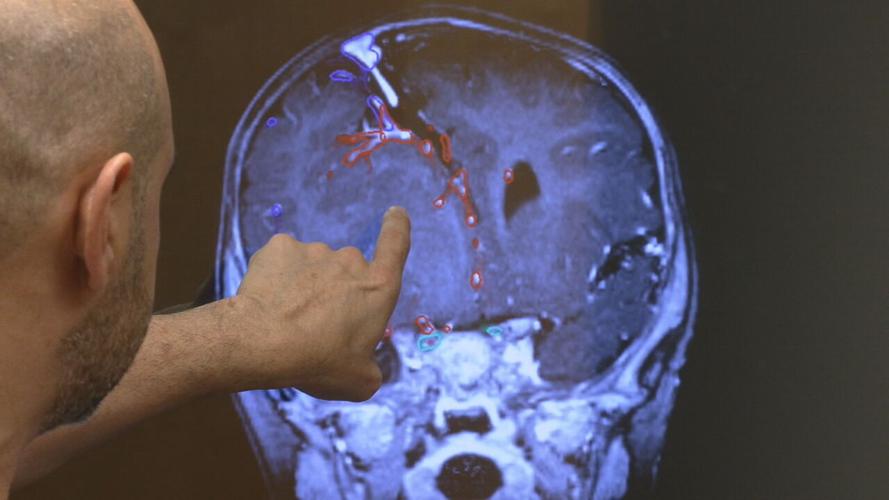 Norton VR Technology For Surgeries