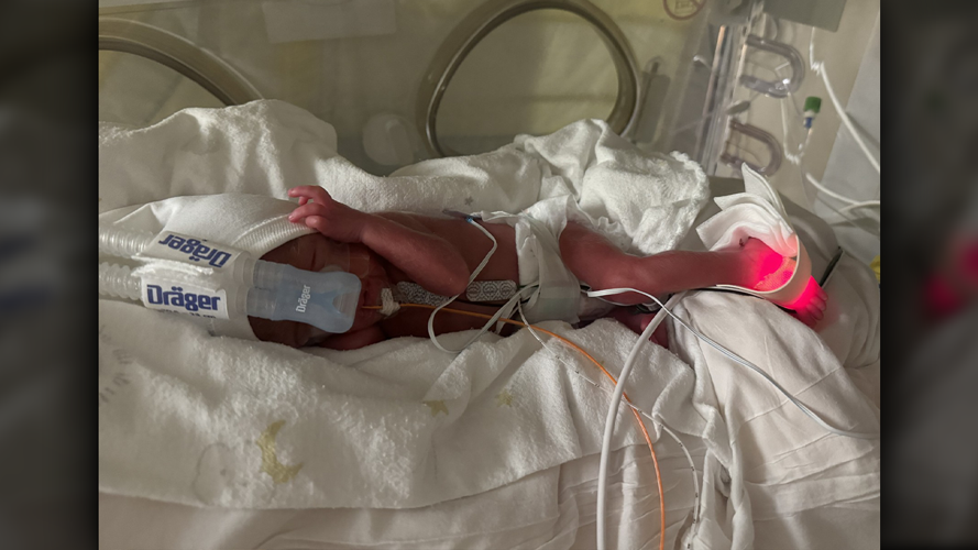 Myers baby at Norton's NICU