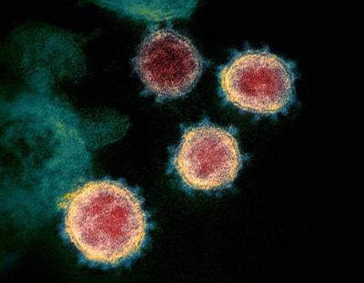 electron microscope image, U.S. National Institutes of Health, COVID-19, novel coronavirus