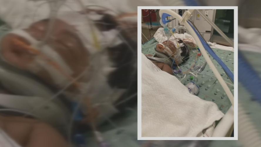 1-YR-OLD GUNSHOT SURVIVOR BRAIN SURGERY UPDATE