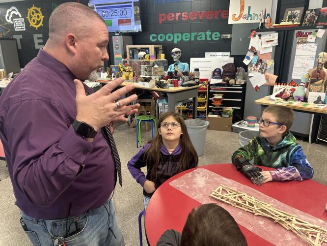Glasgow boy with 3D hand