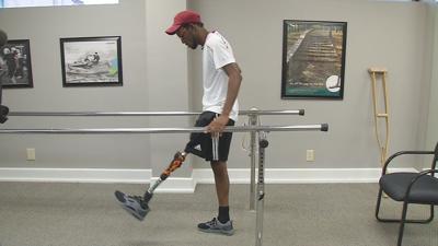 Special Olympics athlete from the Caribbean gets prosthetic leg in Louisville