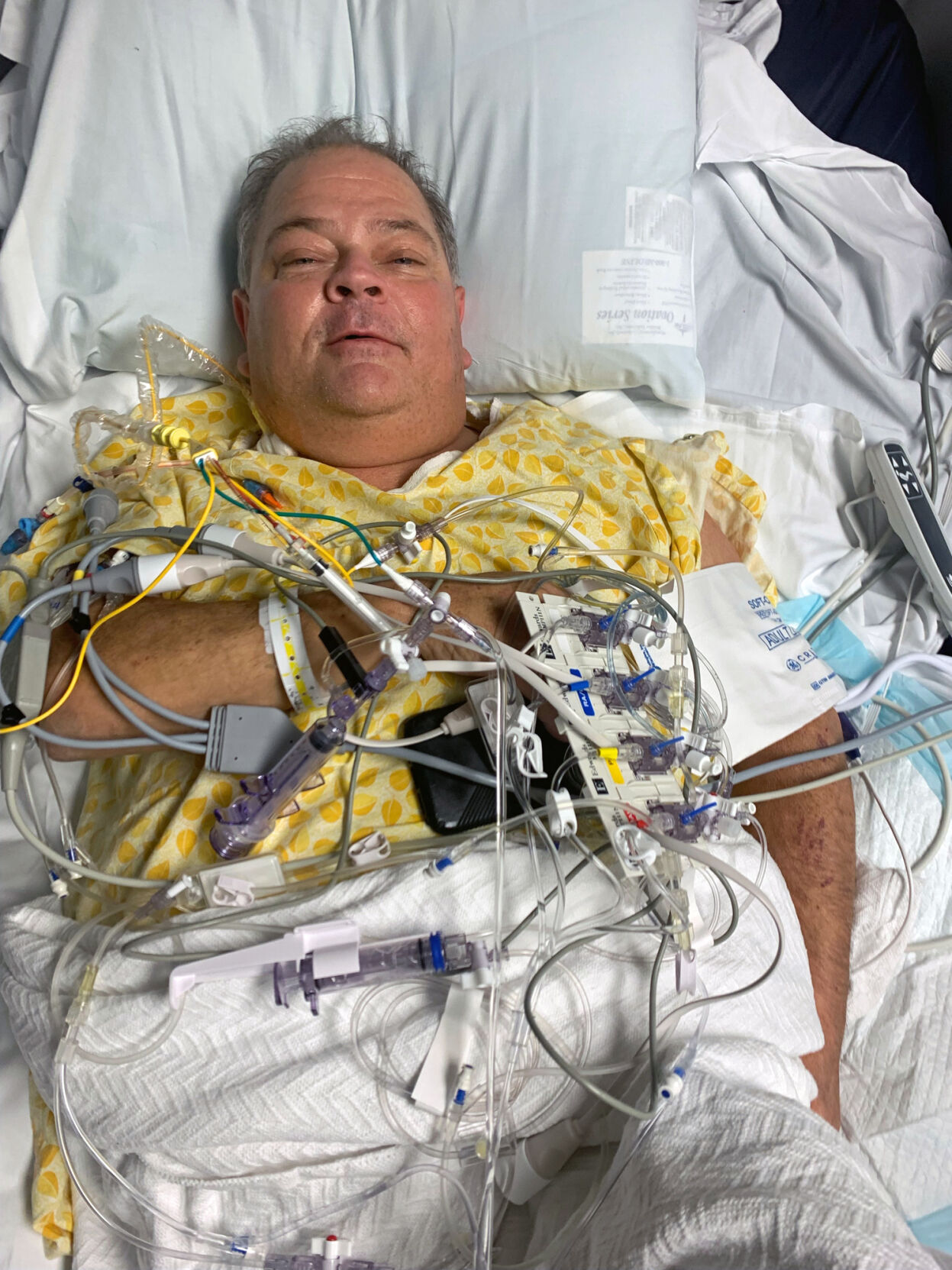 Michael Munday, a patient at UofL Health - Jewish Hospital who received Kentucky's first double-transplant of a heart and liver