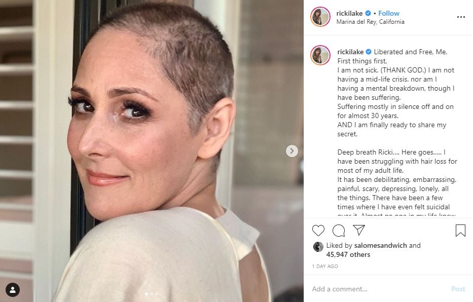Ricki Lake Shows Off Shaved Head After Decades Long Hair Loss Left