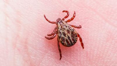 Tick on skin.jpg