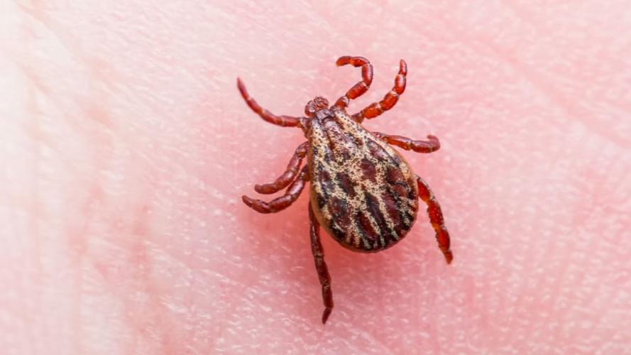 Tick on skin.jpg