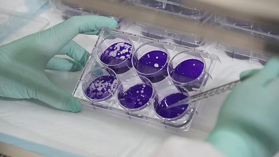 U OF L CO-IMMUNITY RESEARCH - COVID-19 FILE  (3).jpg