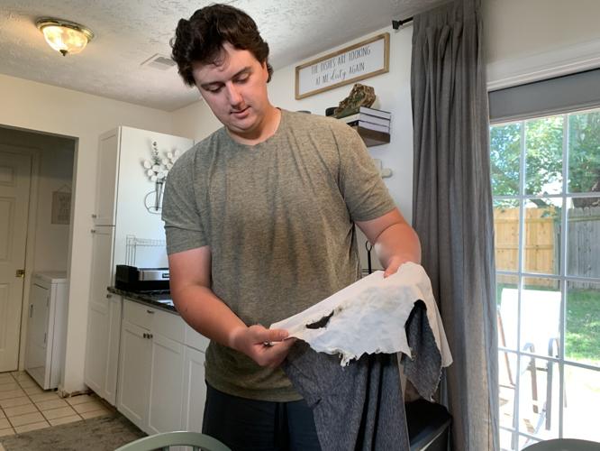 Tyler Morrison shows clothing with holes after he was struck by lightning on Meadowbrook Golf Course