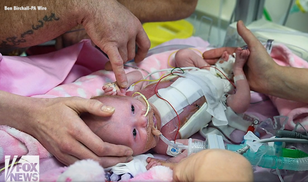 Cleveland Clinic performs its first in utero surgery National