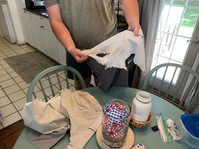 Tyler Morrison displays clothing damaged by lightning