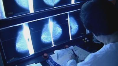 U OF L BREAST CANCER SCREENINGS