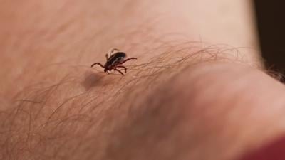 Tick on skin.jpeg