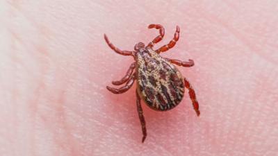A tick on skin.jpeg